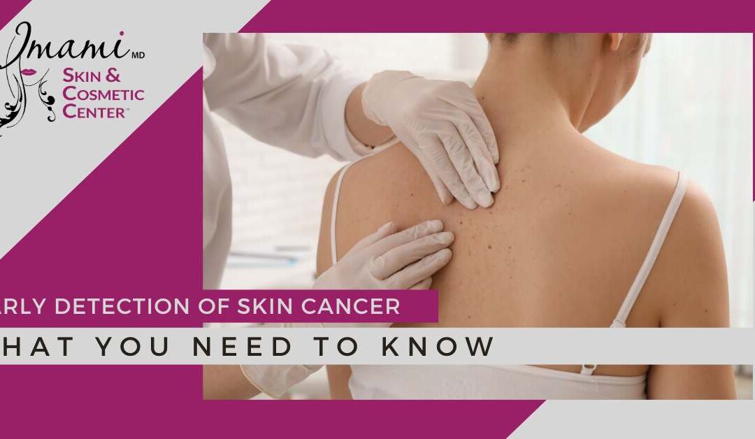 Early Detection of Skin Cancer: What you Need to Know